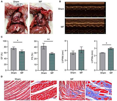 Butyric Acid Ameliorates Myocardial Fibrosis by Regulating M1/M2 Polarization of Macrophages and Promoting Recovery of Mitochondrial Function